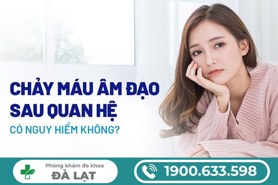 Hình ảnh minh họa